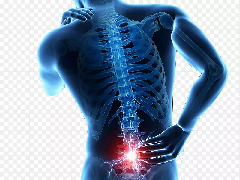 下腰痛-人背部损伤-脊柱-背部疼痛