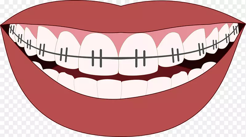 美容牙科正畸牙种植体正畸医师