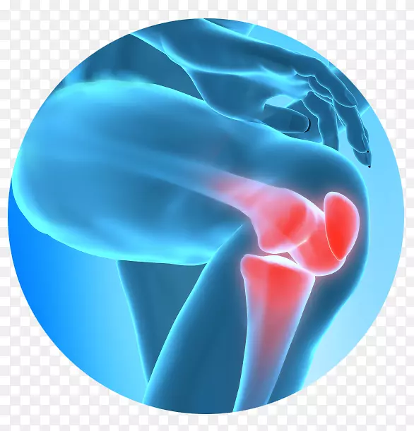 膝关节疼痛治疗疼痛管理-膝关节