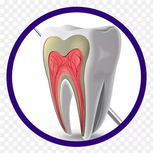蛀牙牙髓牙科软件-牙科学校