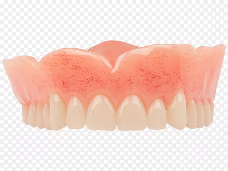 牙齿假牙、牙科种植体