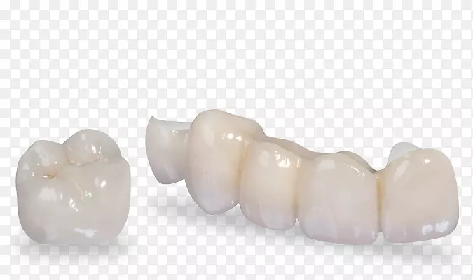 牙冠二氧化锆牙冠