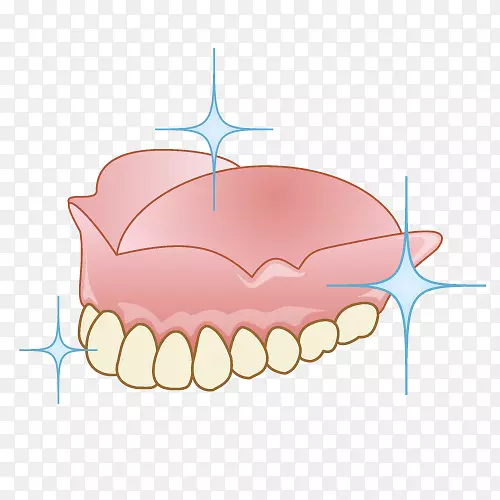 審美歯科牙科义齿治疗-桥