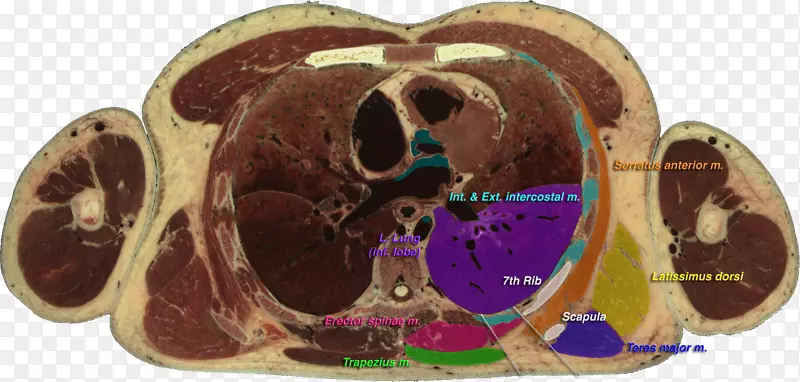 听诊可视人体投影三角解剖胸椎-心脏基础模型
