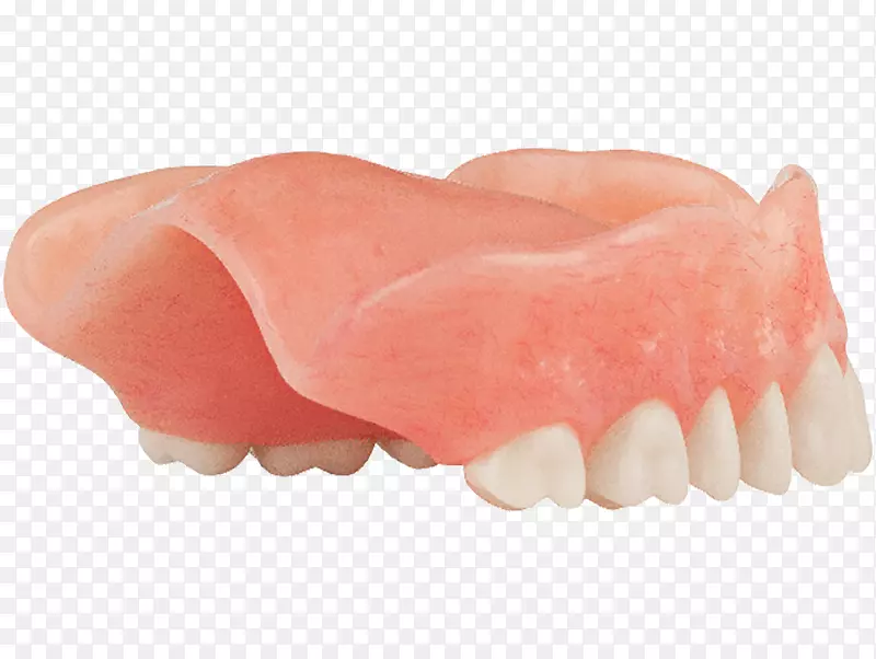 牙义齿牙科颌骨种植体白杨牙