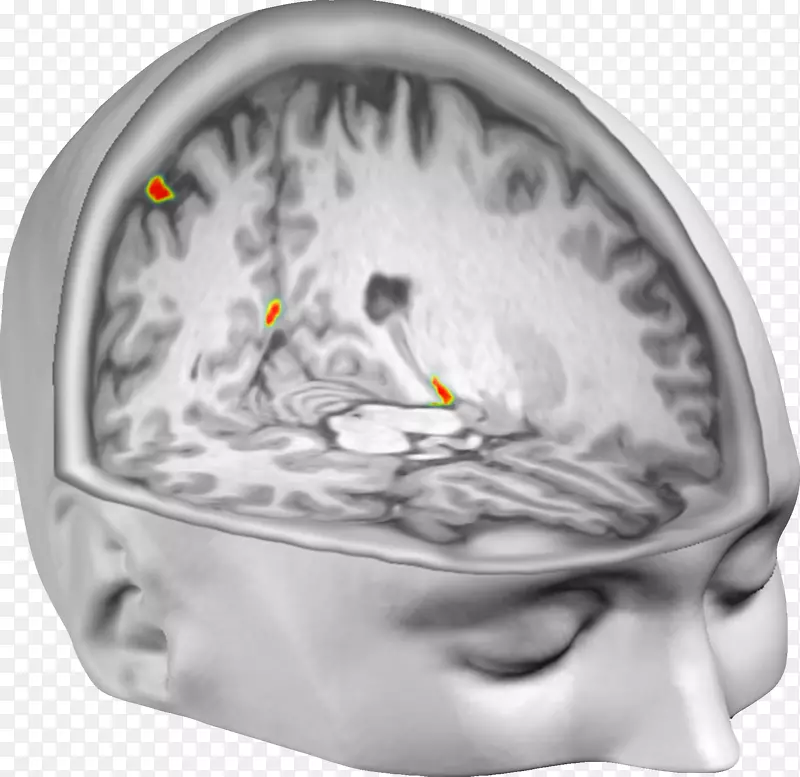 体外经验脑神经科学神经成像-脑