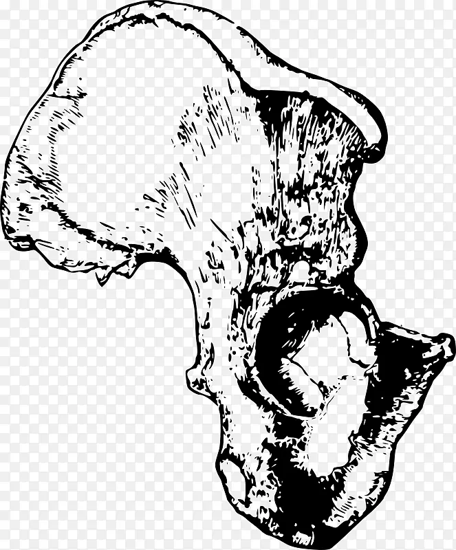 骨盆髋骨解剖夹术骨盆