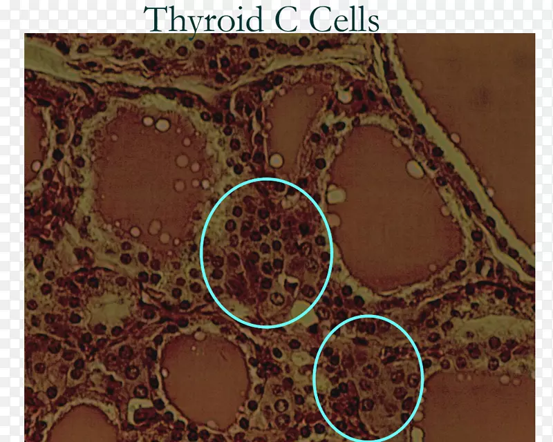 滤泡旁细胞甲状腺内分泌系统-内分泌