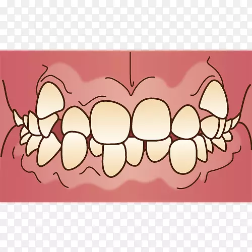 牙科支架矯正歯科牙科护牙.正畸