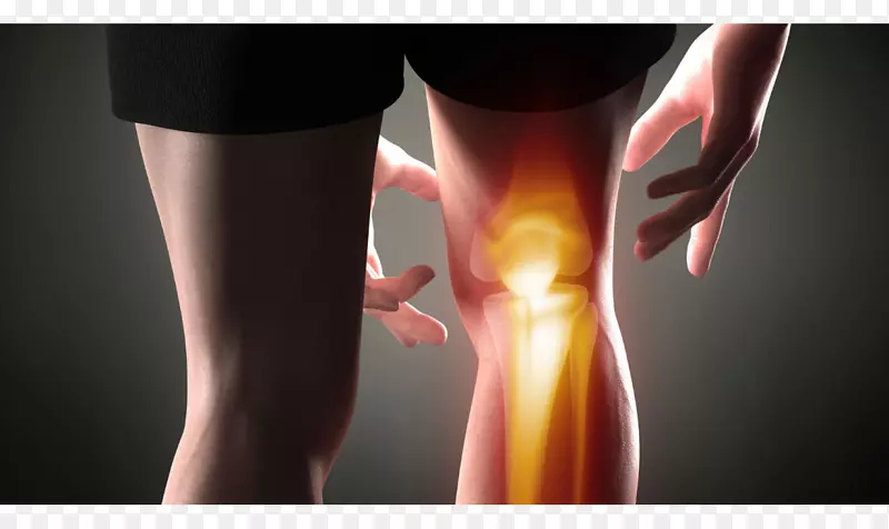 膝关节疼痛管理骨关节炎关节疼痛