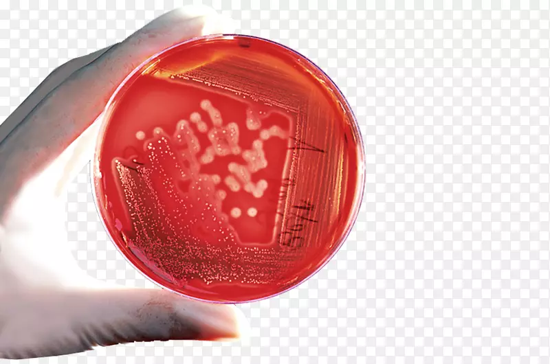 细菌平板计数琼脂细胞琼脂平板-预防感染