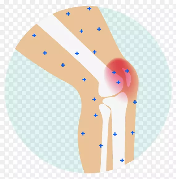 疼痛管理止痛剂关节疼痛关节炎背痛膝痛