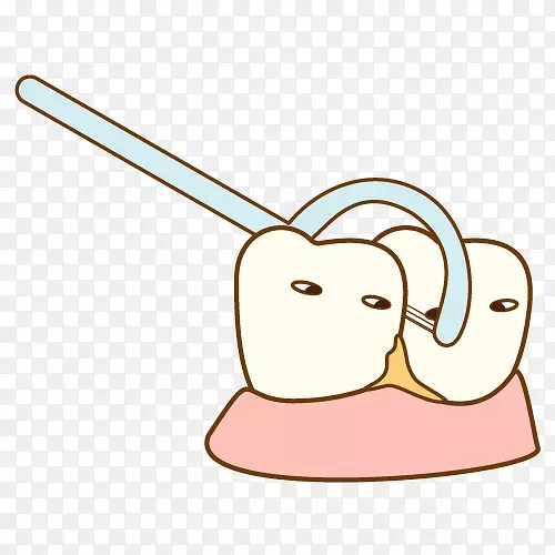 牙石牙科学牙周病牙刷