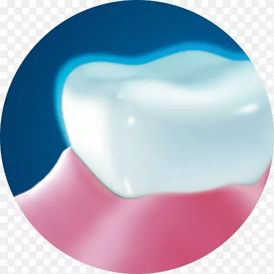 牙膏牙釉质蛀牙牙石牙膏