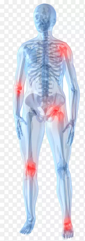 膝关节疼痛管理关节炎关节疼痛治疗-关节疼痛