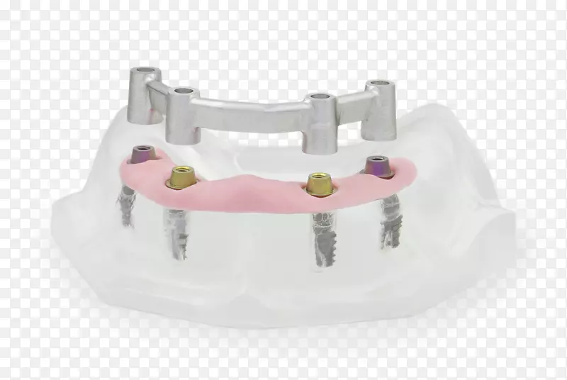 牙科学计算机辅助设计计算机辅助制造设计