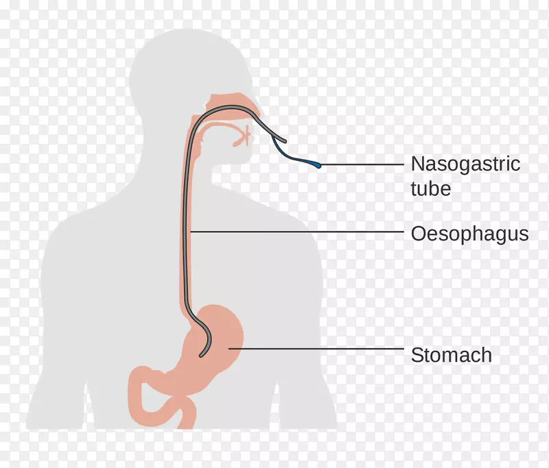 食道癌人体解剖学食道吞咽困难食管切除术-婴儿喂养的正确姿势