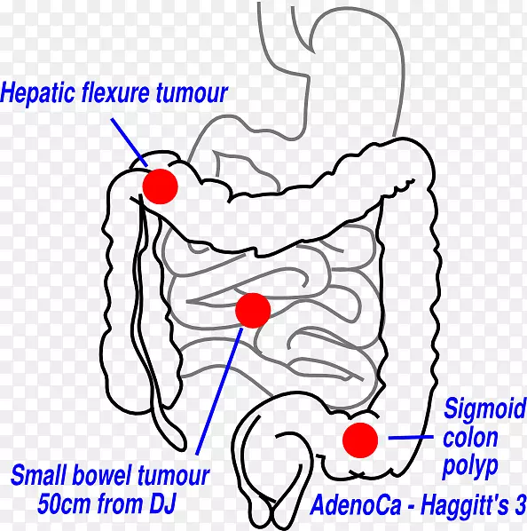大肠、小肠、胃肠道、人类消化系统解剖-多重解剖
