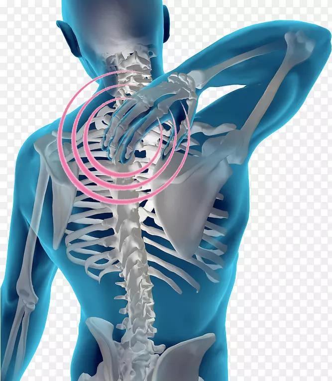 脊柱疼痛人背部颈椎小关节