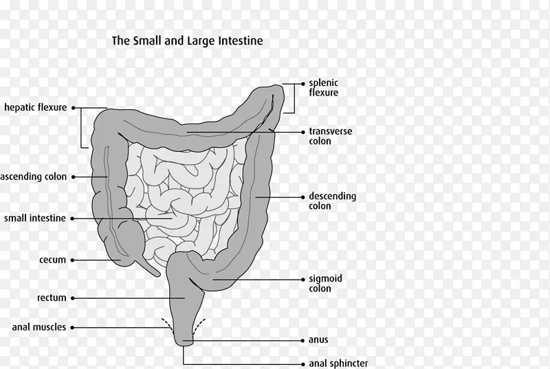 结肠切除术大肠外科乙状结肠-小肠