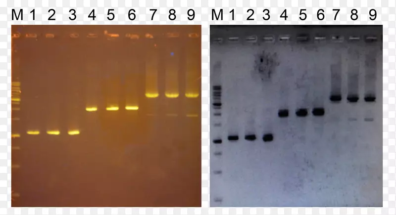 聚合酶链反应琼脂糖凝胶电泳dna Taq聚合酶