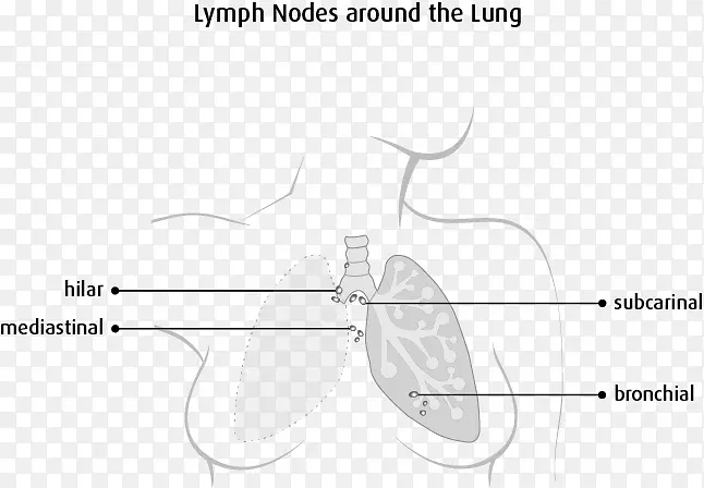 淋巴结淋巴系统纵隔肺癌细胞详情