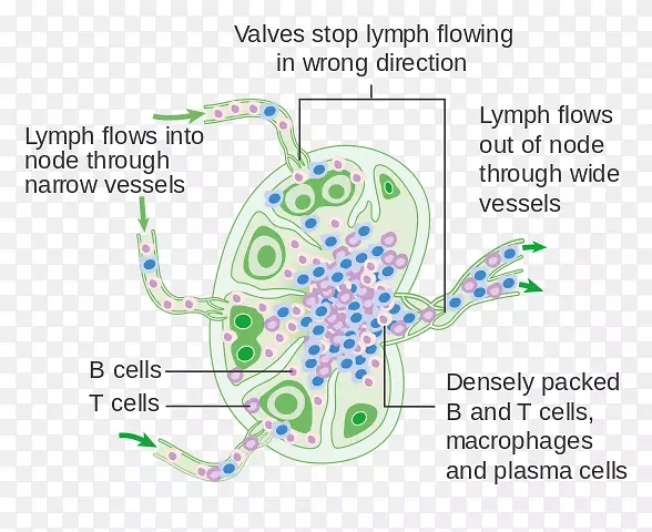 淋巴结人体淋巴系统-癌细胞细节