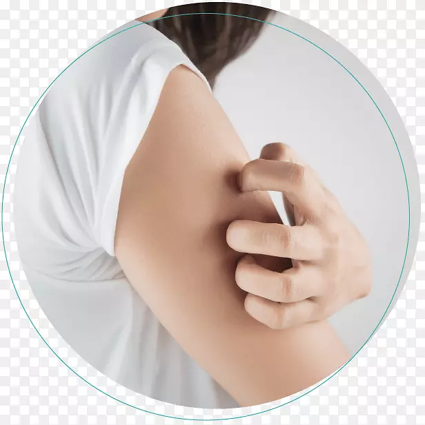 瘙痒症皮肤科：扎伊纳·拉希德，Do，faocd，faad皮疹，手足癣症状臂。