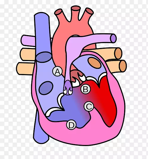 心脏瓣膜夹艺术图法洛四联症