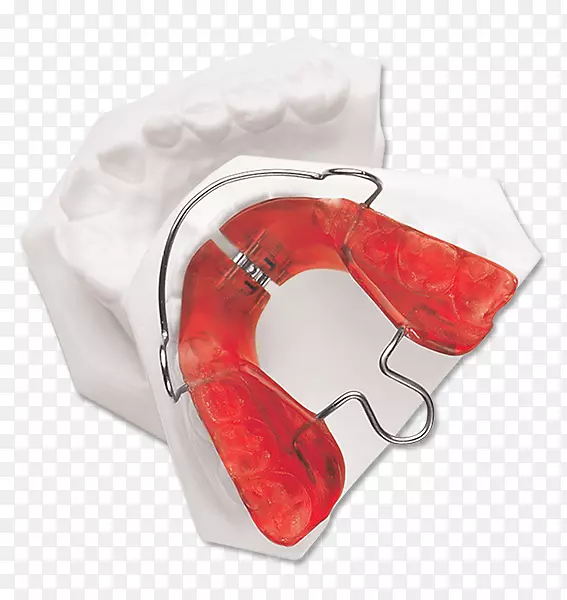正畸学正畸技术仿生器可移动正畸矫治器下颌推进夹板