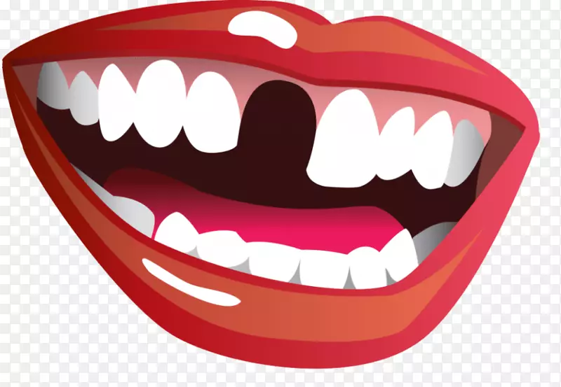 人类牙齿牙科微笑-汤米·彭南特