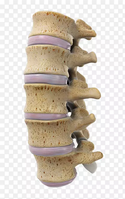 腰椎骶骨矢状面-硬膜外坐骨神经痛