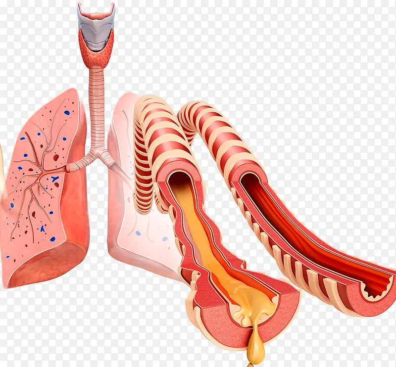 肺部气管粘液