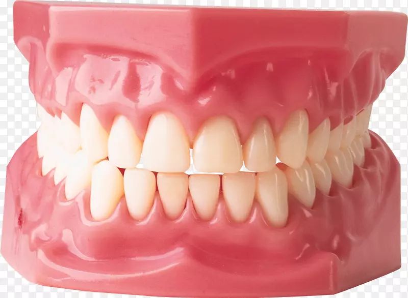 牙龈-牙周炎-牙龈png图像