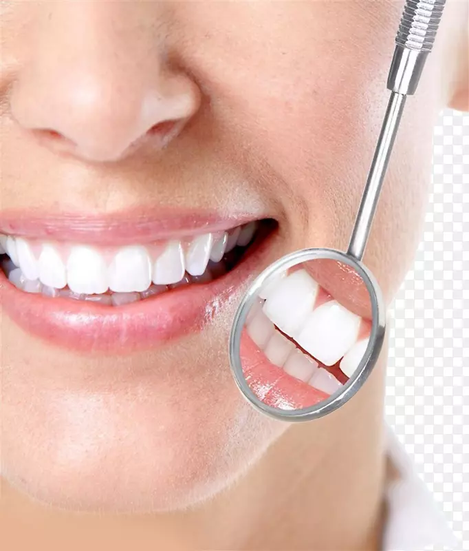 牙科洁白口镜牙清洁.塑料牙