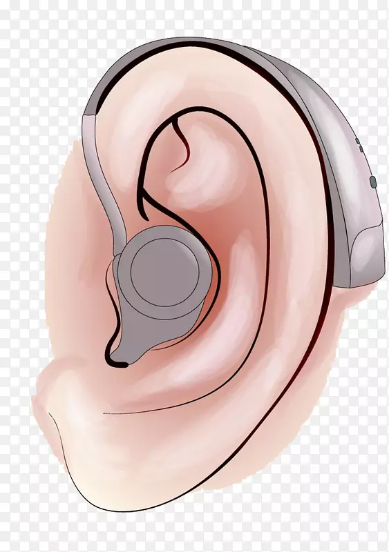 助听器听力损失耳聋助听器