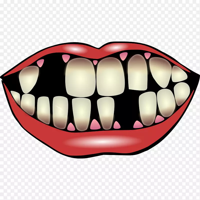 小丑微笑牙齿剪贴画-图像牙齿