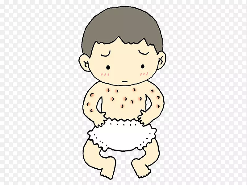 特应性皮炎婴儿卡通形象PNG图片素材下载_图片编号113201-PNG素材网