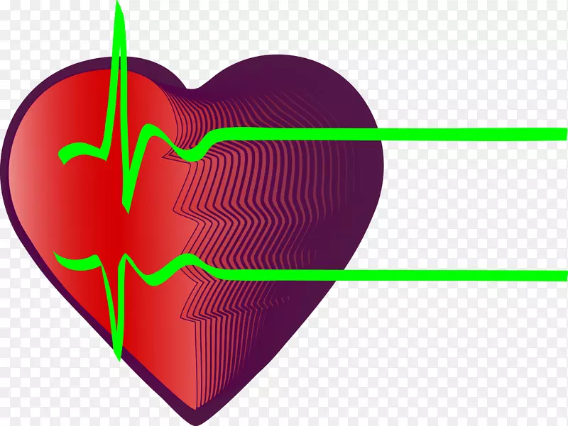 心电图、心率、心肌梗死、冠心病-心脏和绿色心率