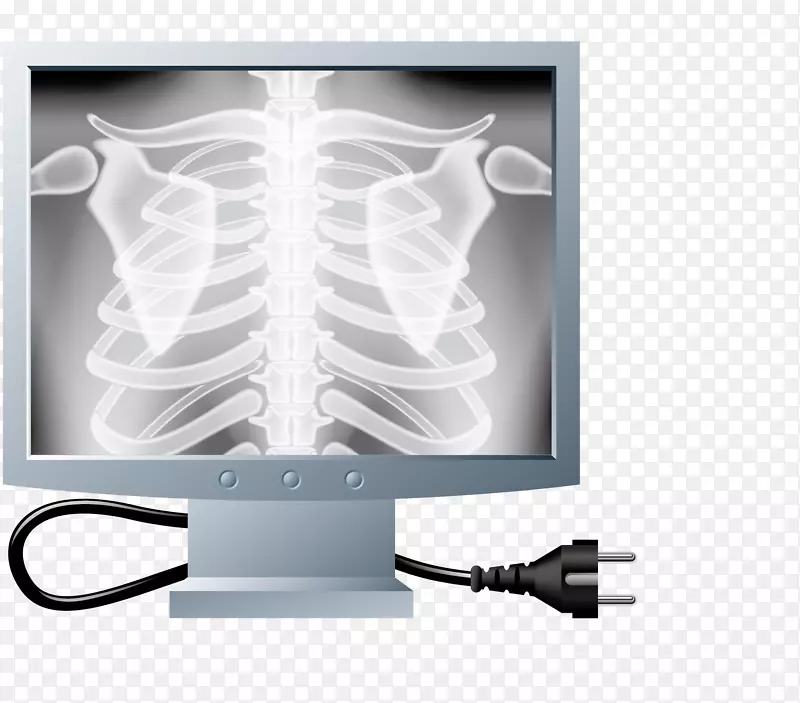 X线肋骨卡通-检查骨骼