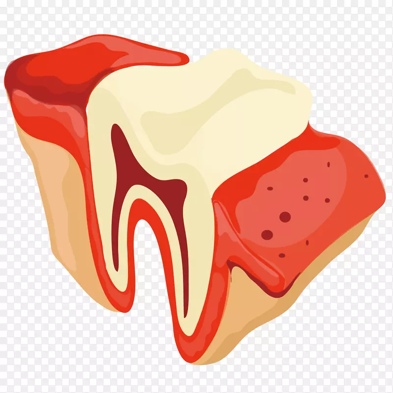 牙牙医牙龈.艺术牙根