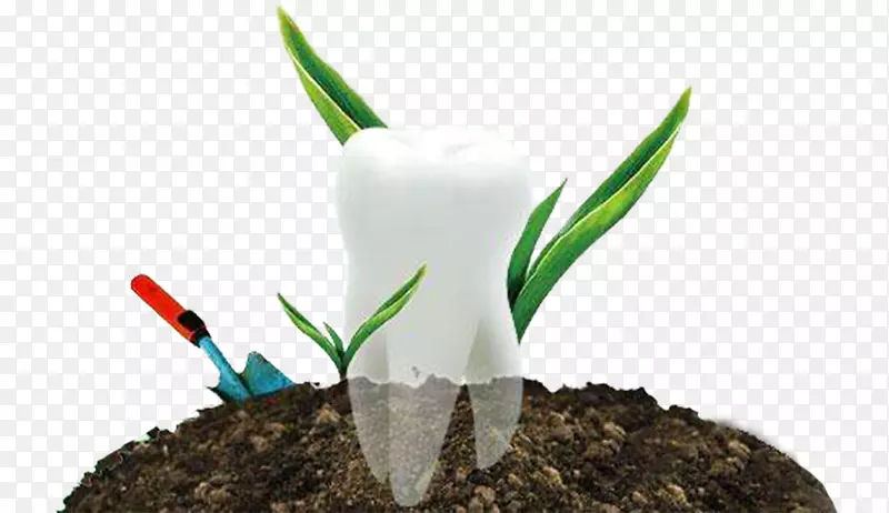牙齿美白假牙种植口-创造种植牙