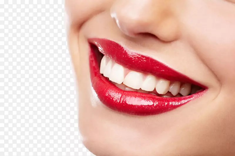 漂白蛀牙微笑牙科.牙齿模型