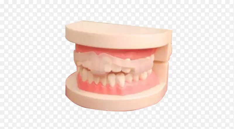 牙齿牙床美容牙科.牙套模型材料