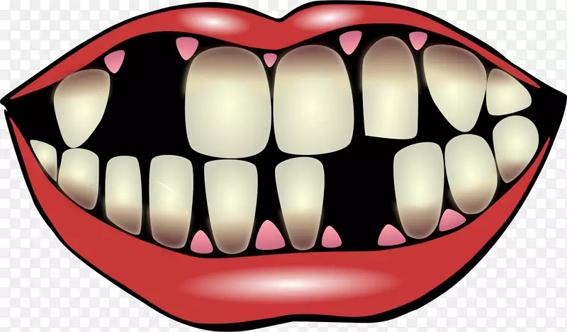 牙齿病理学牙科剪贴画-莫尼