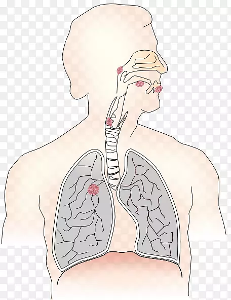 呼吸系统治疗师呼吸无肺最佳影像
