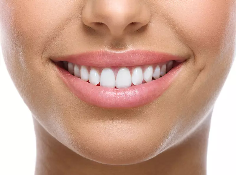 牙齿美白美容牙科微笑-牙齿