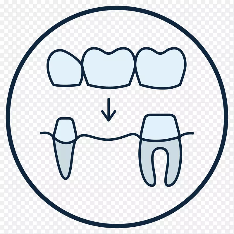 牙齿牙医牙冠假牙斯特里特牙科