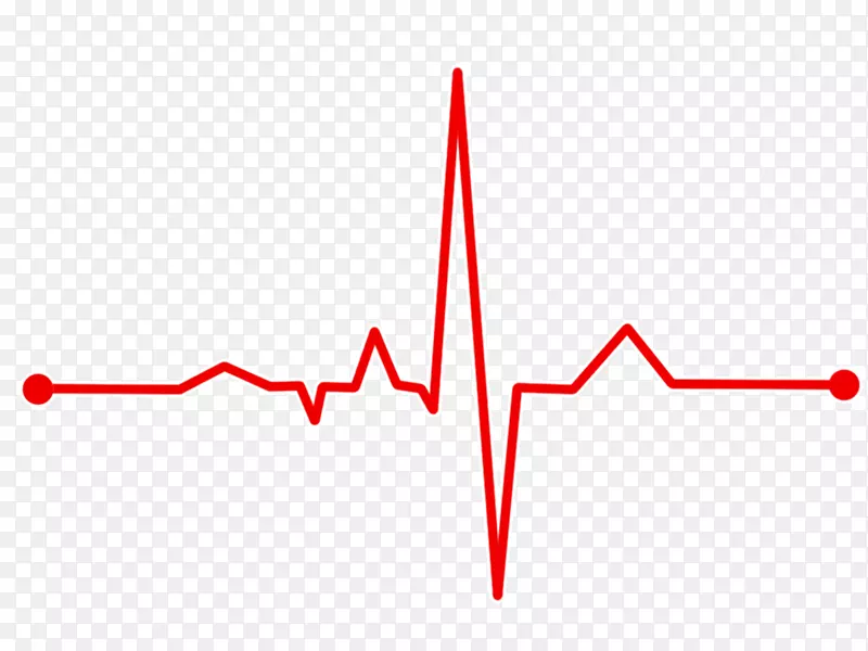 心电图心率脉冲心脏病发作