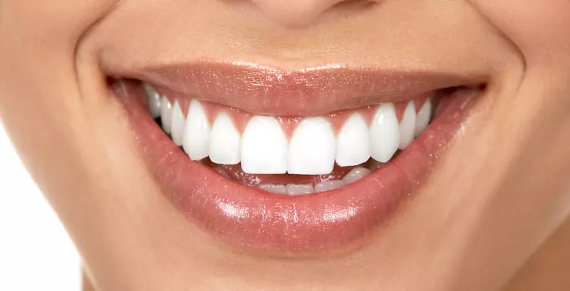 牙科公园实践牙齿美白牙科手术-牙齿